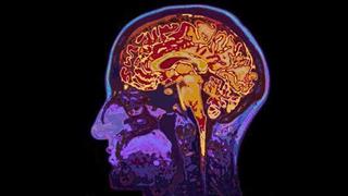 Παχυσαρκία και γήρανση συμβάλλουν στην εμφάνιση νόσου του Alzheimer