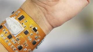 Ερευνητές ανέπτυξαν συσκευή wearable που μετρά τα επίπεδα των αιμοσφαιρίων