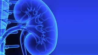 Πέτρα στα νεφρά: Νέα, επαναστατική μέθοδος για ''δύσκολα'' περιστατικά