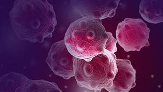 Καρκίνος παγκρέατος: Πώς αντιμετωπίζεται