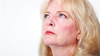 7 παθήσεις που προκαλούν κοκκίνισμα στο πρόσωπο