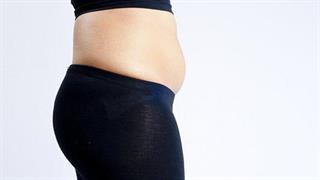 Τοπικό πάχος: Μπορεί να καταπολεμηθεί αποτελεσματικά;