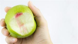 Ανακαλύφθηκε σχέση μεταξύ περιοδοντίτιδας και νόσου του Alzheimer