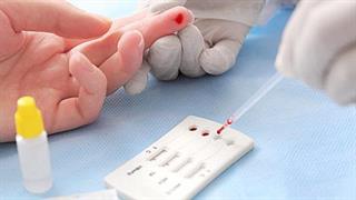 Ηπατίτιδα C: Χρήσιμες πληροφορίες για μια ''σιωπηλή νόσο''