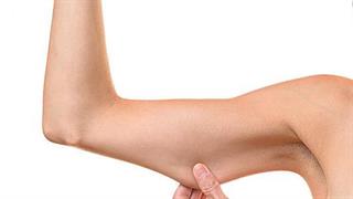 Χαλάρωση μετά από απώλεια βάρους; Όχι πια