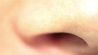 Μπορεί η ρινοπλαστική να διορθώσει μόνο τα μεγάλα ρουθούνια μου;