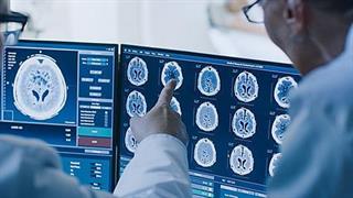 Μείωση δημόσιων δαπανών Υγείας την περίοδο '15 - '17. Πιο κάτω και από το δεύτερο Μνημόνιο