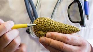 Έρευνα συνδέει την αύξηση των περιστατικών θανάτου από καρκίνο στο πάγκρεας με το επιπλέον βάρος