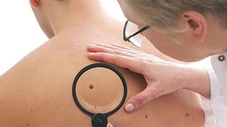 Πρώτη έγκριση του pembrolizumab ως επικουρική θεραπεία στην Ευρωπαϊκή Ένωση