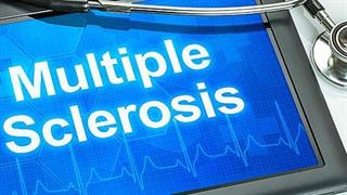 Καινοτόμος θεραπεία για την πολλαπλή σκλήρυνση