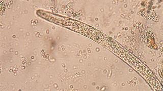 Απαγόρευση χρήσης νεονικοτινοειδών