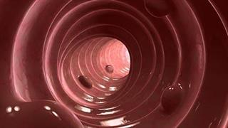 Χρόνια φλεγμονώδης νόσος του εντέρου: Η ανάλυση κοπράνων μπορεί να προβλέψει την ανταπόκριση σε αντι - TNF θεραπεία