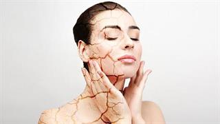 Τι να κάνω για το ξηρό και αφυδατωμένο δέρμα