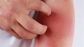 Η Sanofi και η Regeneron εγκαινιάζουν την πρωτοβουλία  ‘Agents of Change’ AD Challenge