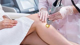 Οι 7 πιο συχνές ερωτήσεις για την αποτρίχωση με λέιζερ