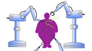Ρομποτική χειρουργική παχυσαρκίας