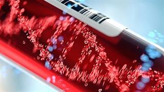 Εξέταση αίματος προβλέπει τον κίνδυνο Aυτοάνοσων Nοσημάτων