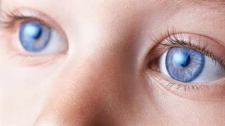 Εφαρμογή για smartphone εντοπίζει οφθαλμοπάθειες στις φωτογραφίες παιδιών