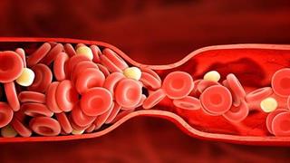 Χοληστερόλη: Μπορεί να επηρεάσει τη γονιμότητα;