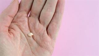 Η απώλεια δοντιών μετά την εμμηνόπαυση συνδέεται με υπέρταση