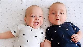 Η ένταση συμπτωμάτων αυτισμού ποικίλλει ευρέως σε μονοζυγωτικούς διδύμους