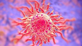 Δημοσιεύτηκε η μεγαλύτερη μελέτη μοριακού προφίλ όγκων στην Ελλάδα