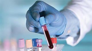 Συχνές οι αιματολογικές επιπλοκές της λοίμωξης από κορωνοϊό