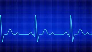 ΕΚΕ : Δωρεά φορητών καρδιογράφων σε Κέντρα Υγείας και Υπερηχογράφων «παλάμης» στα νοσοκομεία αναφοράς