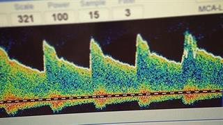 Υπερηχογραφική διερεύνηση ασθενών με αγγειακό εγκεφαλικό επεισόδιο στην πανδημία