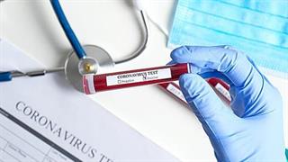 Συμμαχία Γερμανίας, Γαλλίας, Ιταλίας, Ολλανδίας για το εμβόλιο του κορωνοϊού