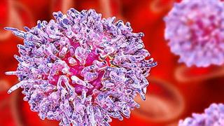 Θετικά αποτελέσματα φάσης III για το Venetoclax στην οξεία μυελογενή λευχαιμία