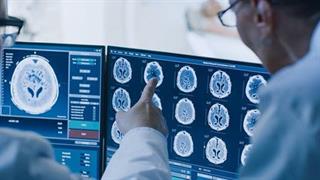 Νέο σύστημα στην αγορά από την Roche Diagnostics 