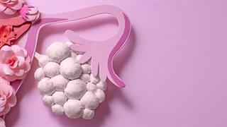 Νέες γυναίκες με σύνδρομο πολυκυστικών ωοθηκών έχουν αυξημένο κίνδυνο καρδιοπάθειας