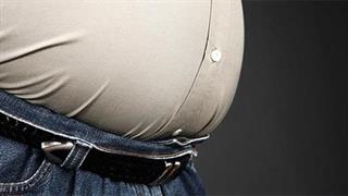 Η ανδρικού τύπου παχυσαρκία συνδέεται με τον καρκίνο του προστάτη