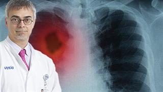 Στέφανος Λαμπρόπουλος: Θεραπευτικές εξελίξεις στον καρκίνο του πνεύμονα