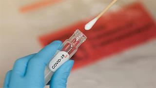 Ερώτηση Ανδρέα Ξανθού στον υπουργό Υγείας για τα μοριακά τεστ κορωνοϊού  