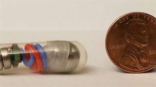 Συσκευή εγκαθίσταται στο στομάχι και αντιμετωπίζει προβλήματα