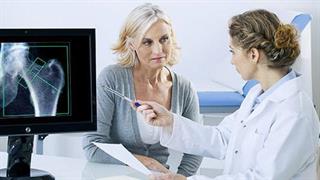 Οστεοπόρωση: Μια συχνή πάθηση των γυναικών