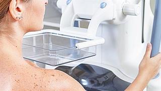 Πώς θα γίνονται οι δωρεάν μαστογραφίες