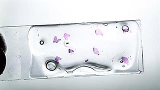 Ποιο είναι το έργο του παθολογοανατόμου;