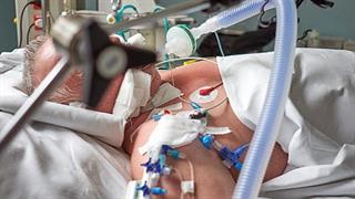 Ελβετοί εντατικολόγοι στους πολίτες: Κάνετε διαθήκη για το πώς θέλετε να πεθάνετε!