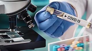 Ανεξήγητα μεγάλη μείωση στα τεστ κορωνοϊού
