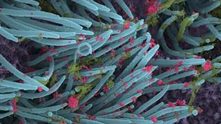 Εικόνα του SARS-CoV-2 να προσβάλλει τα κύτταρα του αναπνευστικού [φωτογραφίες]              