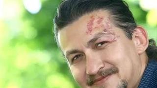 Κώστας Μπλούχος : H πρωτοχρονιάτικη εφημερία ενός βουλευτή στο νοσοκομείο Δράμας