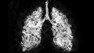 Καρκίνος στο μαστό: H νικοτίνη προάγει τη μετάσταση στον πνεύμονα