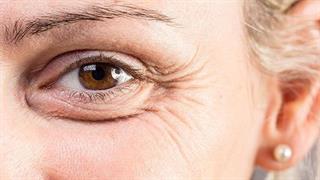 7 επιστημονικά αποδεδειγμένοι τρόποι για να αποφύγετε τις ρυτίδες