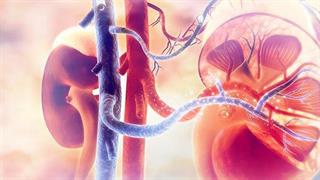 Έγκριση πρώτης γραμμής θεραπείας για ασθενείς με προχωρημένο νεφροκυτταρικό καρκίνωμα