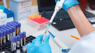 ΕΥ: Δείκτες μέτρησηςτης δημιουργίας μακροπρόθεσμης αξίας στον κλάδο των βιοεπιστημών