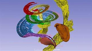 Ερευνητές δημιούργησαν τρισδιάστατο χάρτη ηχητικών συχνοτήτων στον κοχλία