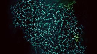 fabryfamilytree.gr: Νέα πλατφόρμα ενημέρωσης για άτομα με νόσο Fabry και τις οικογένειές τους